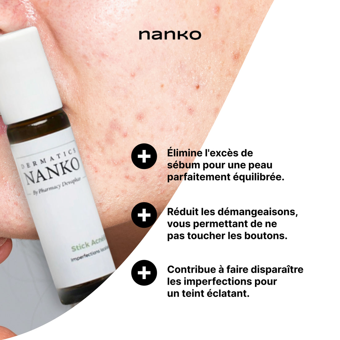 Stick Acnélift