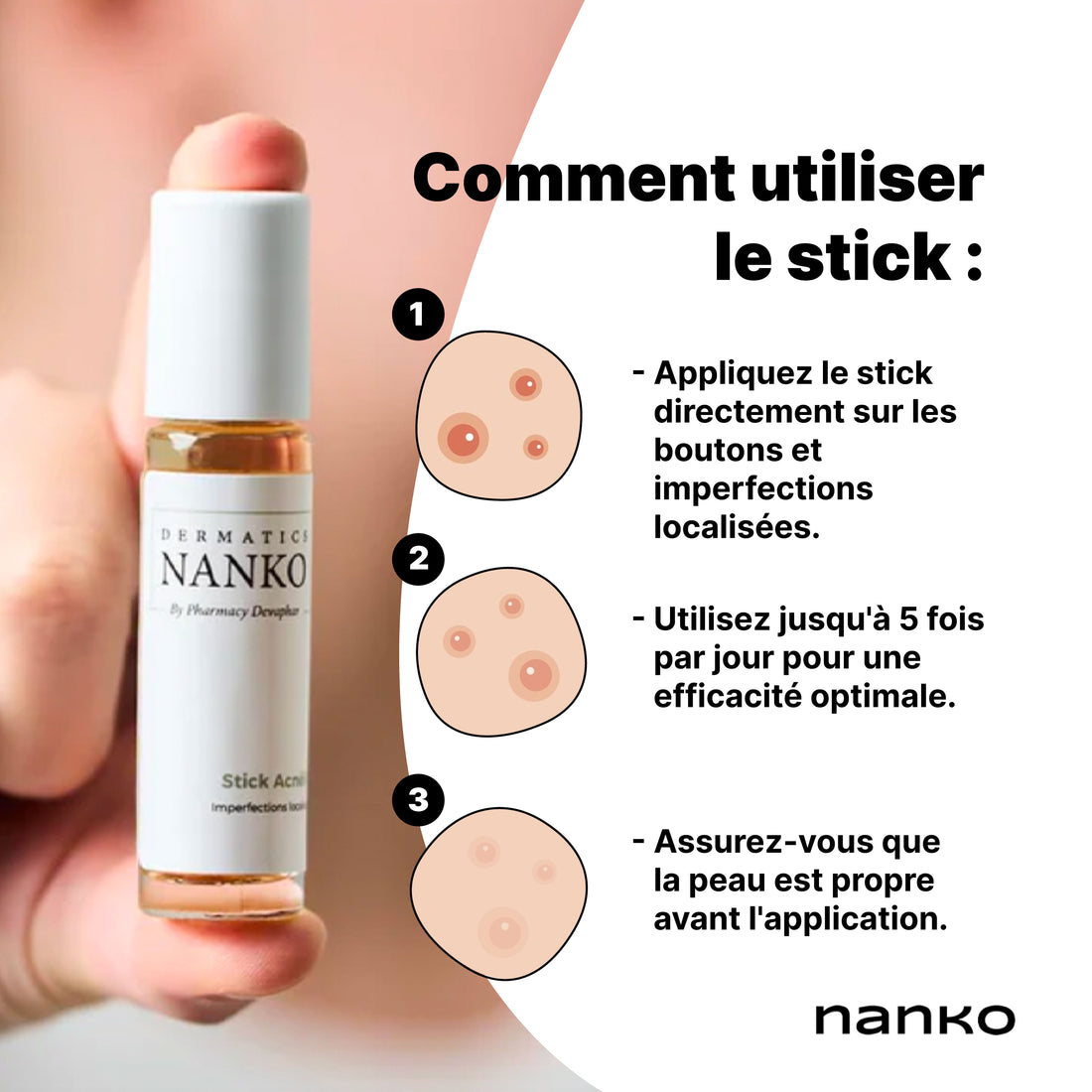 Stick Acnélift